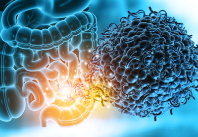 Острые кишечные инфекции: причины, симптомы, профилактика
