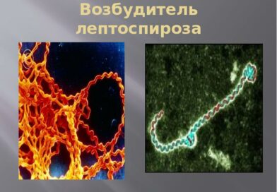                        Что такое лептоспироз?